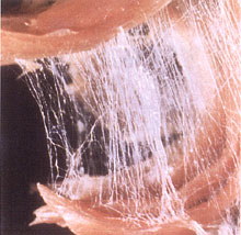 筋膜のイメージ画像
